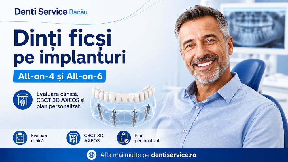 Dinti permanenti pe implanturi in Bacau cand pot fi considerate solutiile All on 4 si All on 6