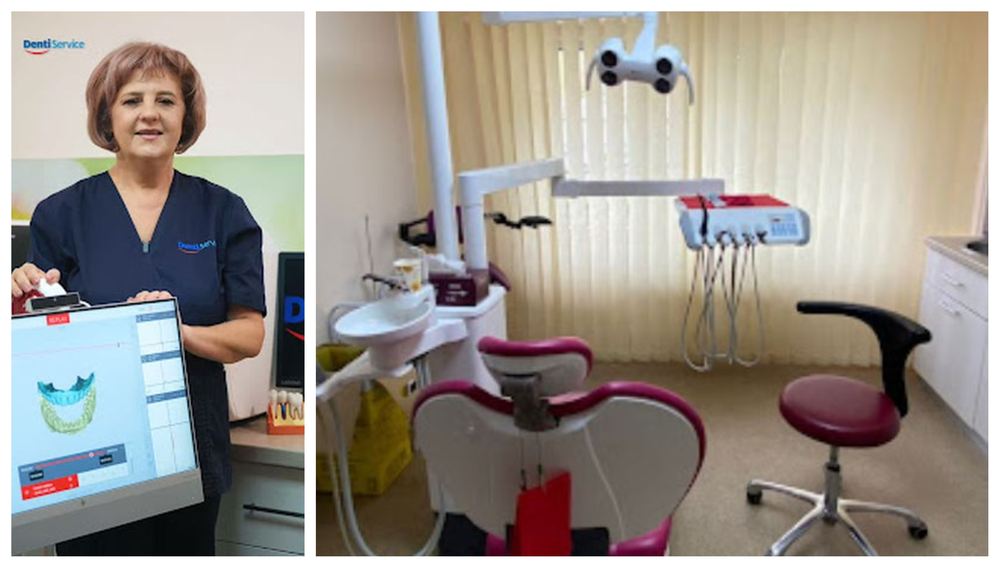 Dintii se tocesc fara sa iti dai seama Ce semnale da bruxismul si cand ar trebui sa evaluam uzura dentara